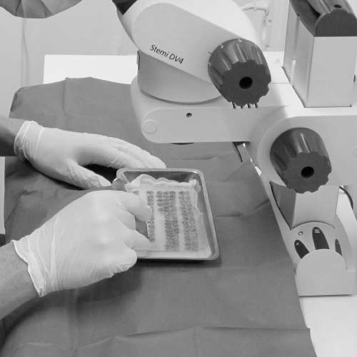 Haartransplantation und Haarverpflanzung in Berlin - Novohair